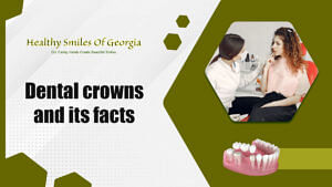 Dental Crowns And Its Facts