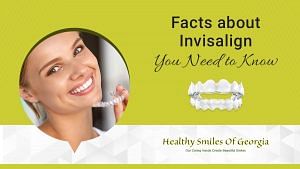 Top 10 Facts About Invisalign