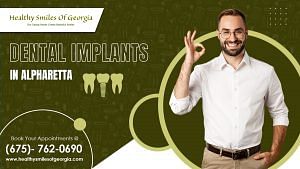 Are you a suitable candidate for dental implant treatment in Georgia?
